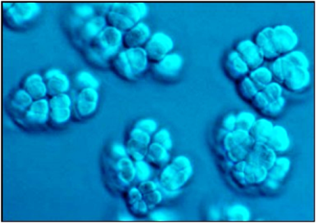 Methanogens under a microscope; Source: oilprice.com